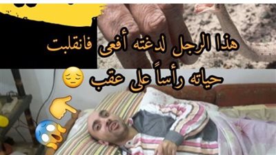 قصة حقيقية لرجل لدغته افعي